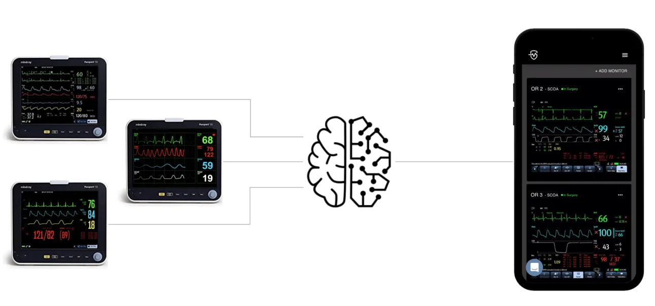 Guardian machine learning model for operating room monitoring