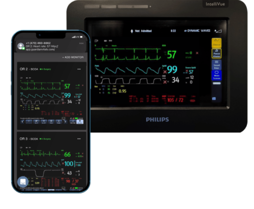 Guardian app for monitoring vitals in operating rooms