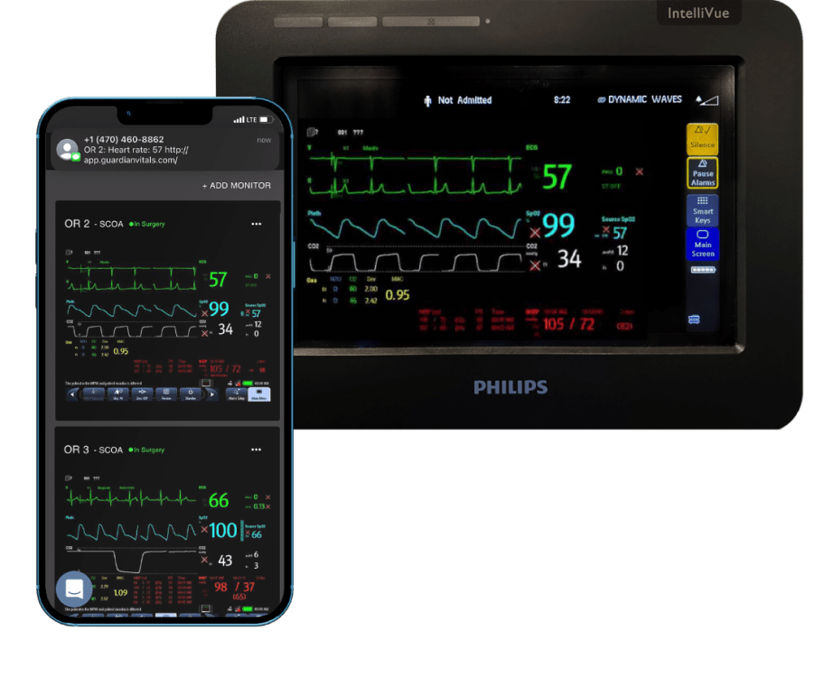 Guardian app for monitoring vitals in operating rooms