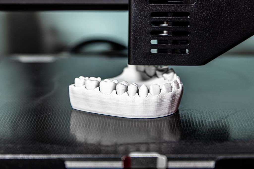 3D printed teeth